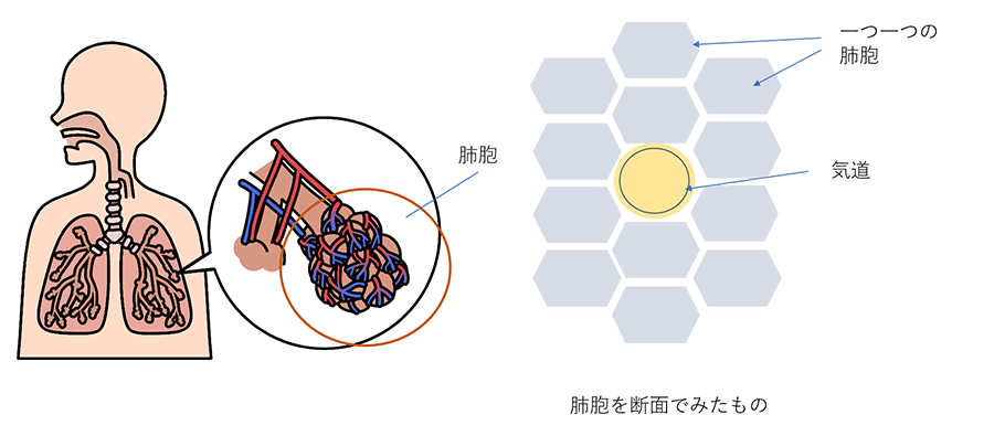 正常肺胞のイメージ