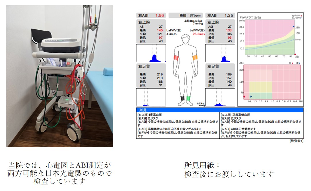 ABI検査機器と所見用紙